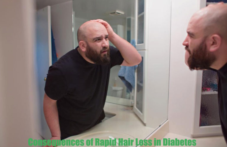 What Are The Main Causes Of Rapid Hair Loss In Diabetes 
