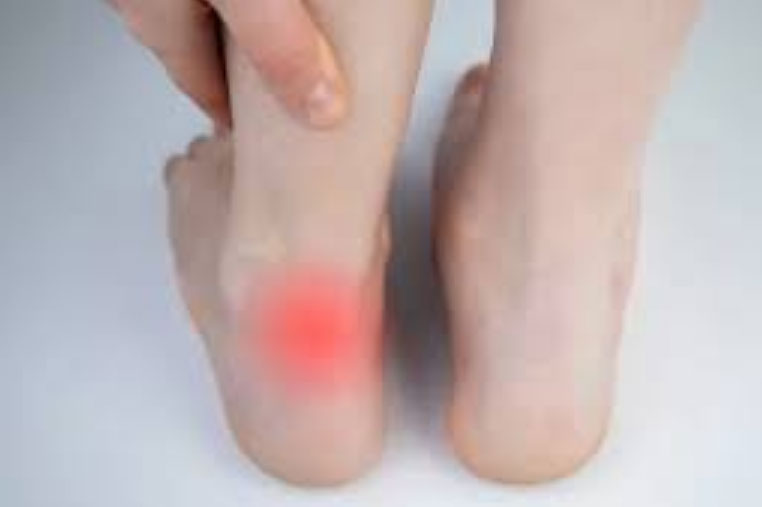 treat-heel-pain-from-plantar-fasciitis