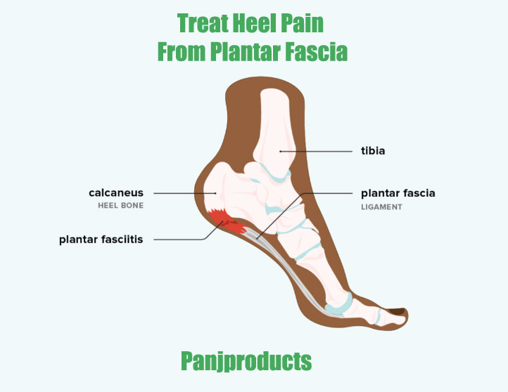 treat-heel-pain-from-plantar-fasciitis2